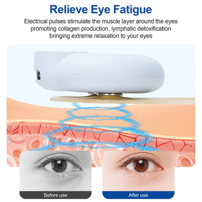 Microcurrent Eye Massager for Youthful, Bright Eyes